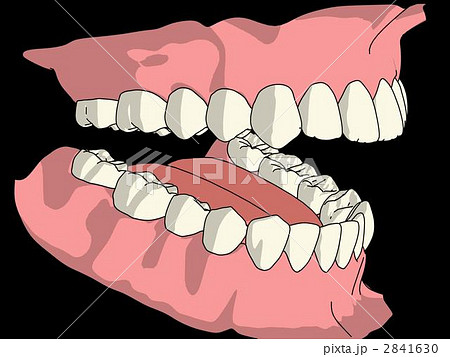 犬歯のイラスト素材