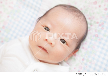 新生児黄疸の写真素材