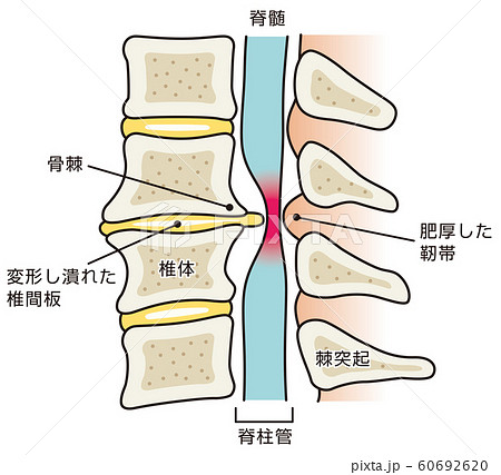 腰骨 図 断面図のイラスト素材