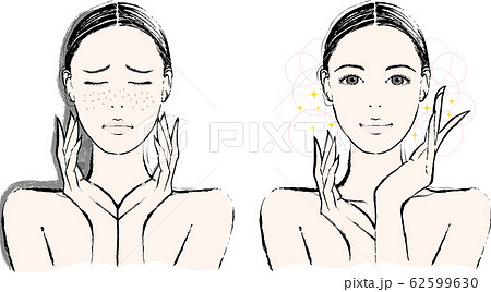そばかすのイラスト素材