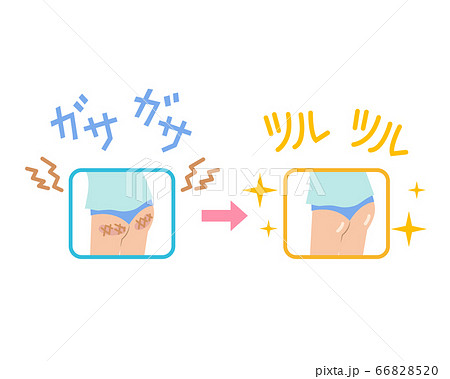 腰 お尻のイラスト素材集 ピクスタ
