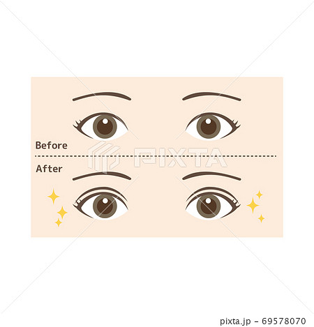 二重まぶたのイラスト素材