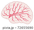 脳血管性認知症の脳のイラストのイラスト素材