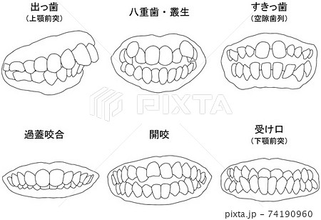 しゃくれのイラスト素材