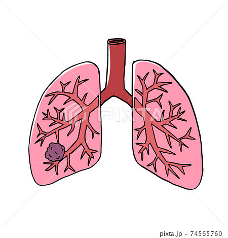 細気管支のイラスト素材