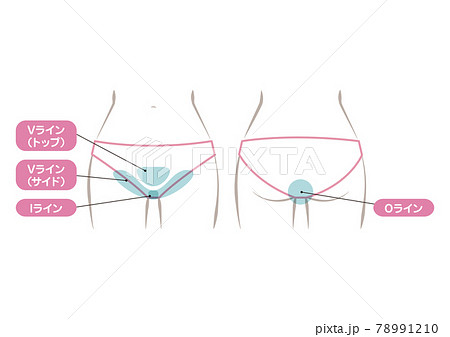 Vioのイラスト素材