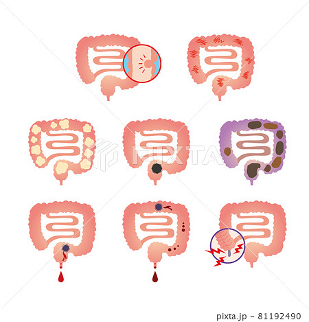 腸のイラスト素材