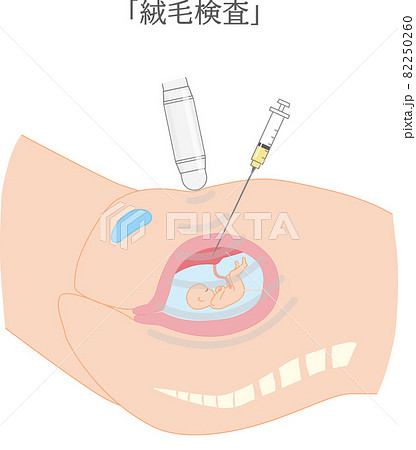 羊水のイラスト素材