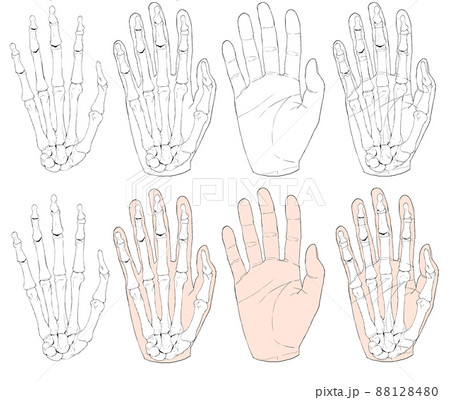 手のケガのイラスト素材